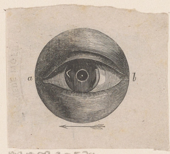 Menselijk oog met een afwijking, Isaac Weissenbruch